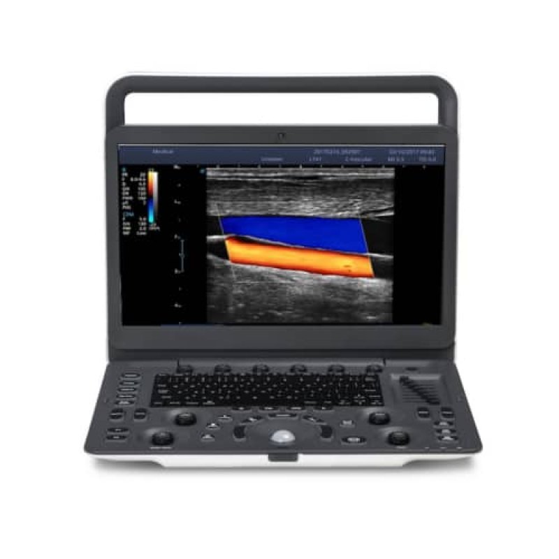 Sonoscape E2 Ultrasound Machine